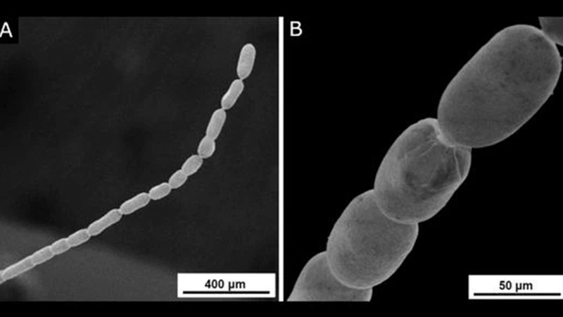 La bacteria más grande jamás descubierta tiene una célula inesperadamente compleja