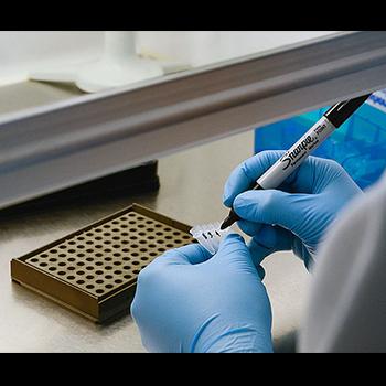 Caracterizan 15 mutaciones de hemofilia B en Colombia