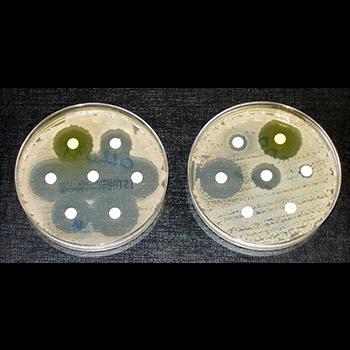 Descubren dos nuevos antibióticos que no generan resistencia