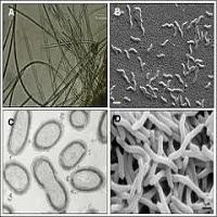 MICROSCOPIO ELECTRONICO DE TRANSMISION