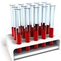 DETERMINACIÓN DE CLORUROS POR GRAVIMETRÍA